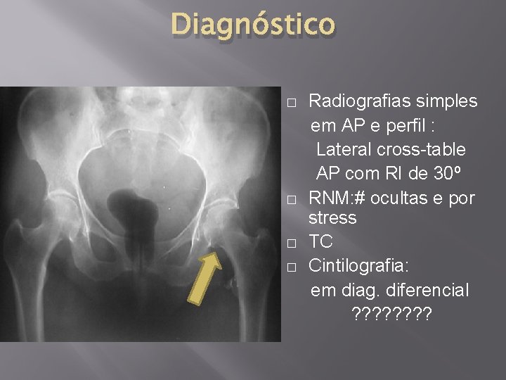 Diagnóstico Radiografias simples em AP e perfil : Lateral cross-table AP com RI de