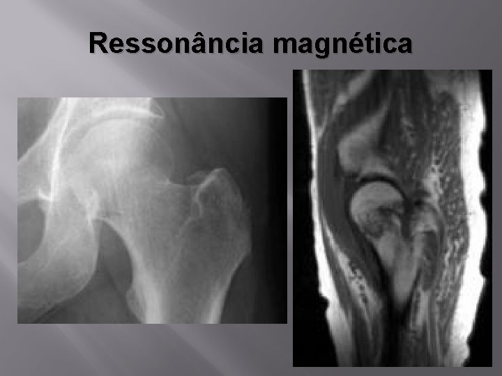 Ressonância magnética 