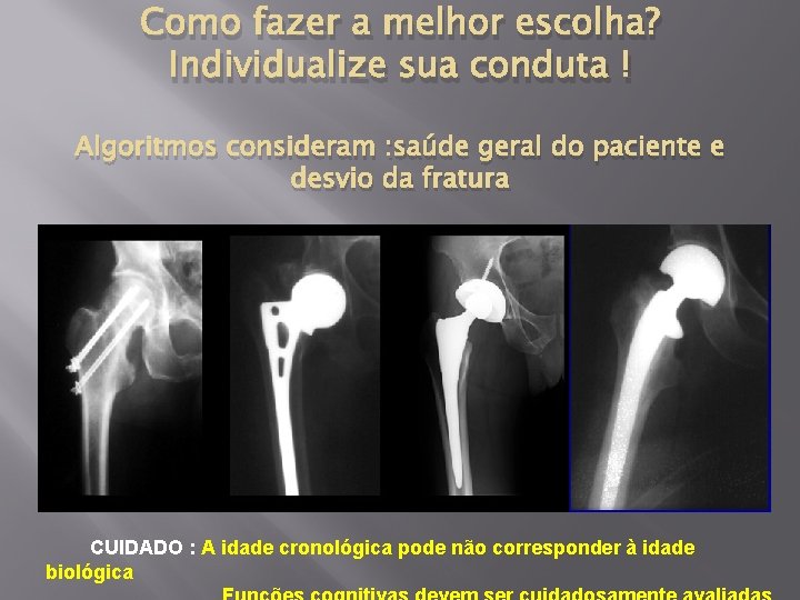 Como fazer a melhor escolha? Individualize sua conduta ! Algoritmos consideram : saúde geral
