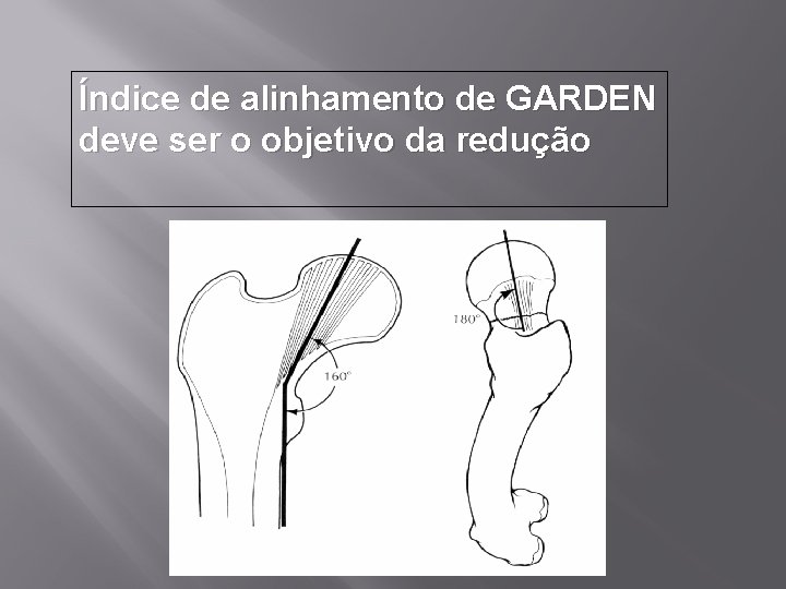 Índice de alinhamento de GARDEN deve ser o objetivo da redução 