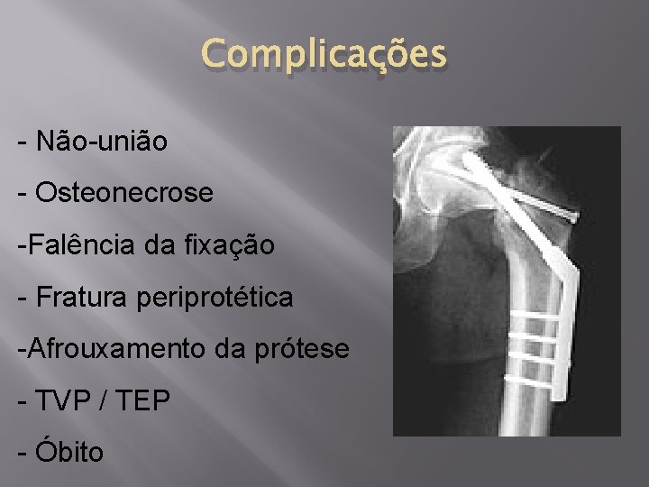 Complicações - Não-união - Osteonecrose -Falência da fixação - Fratura periprotética -Afrouxamento da prótese