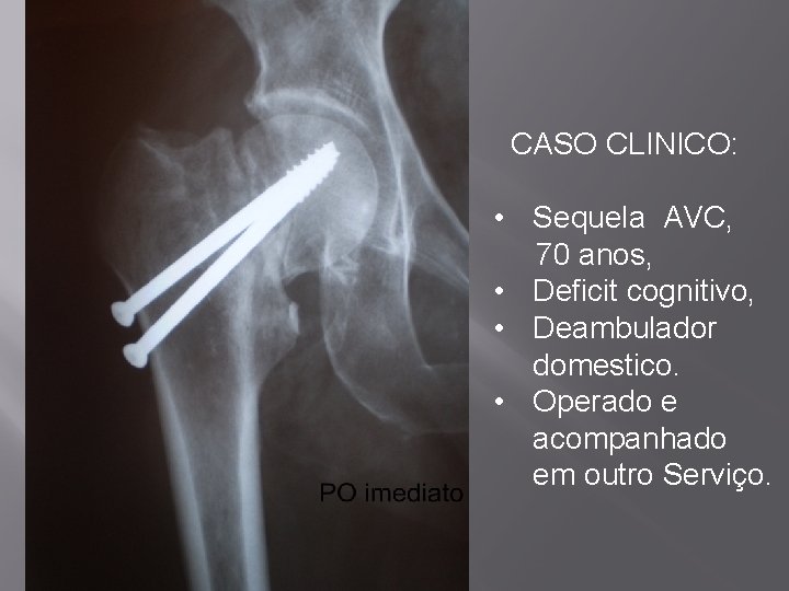  CASO CLINICO: • Sequela AVC, 70 anos, • Deficit cognitivo, • Deambulador domestico.