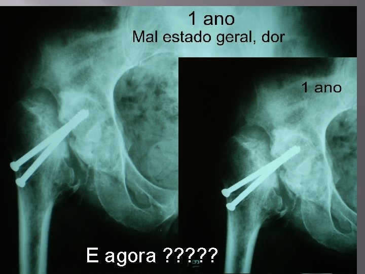 E agora ? ? ? 
