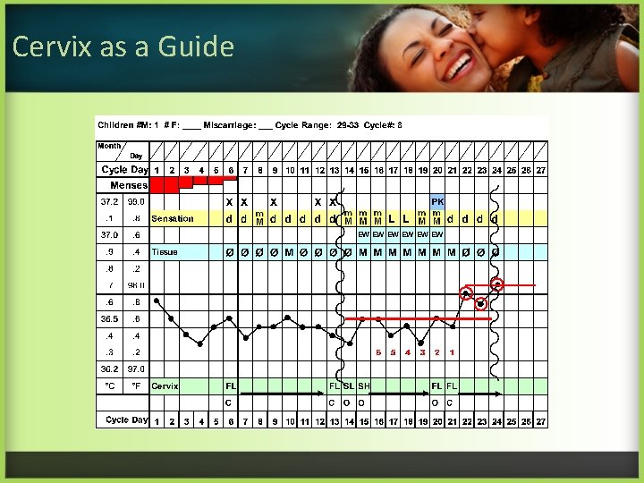 Cervix as a Guide 
