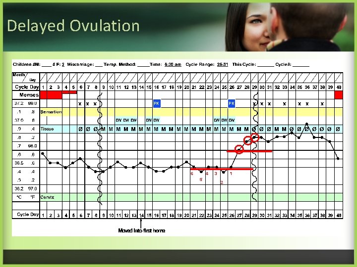 Delayed Ovulation PK PK 6 4 5 3 1 2 