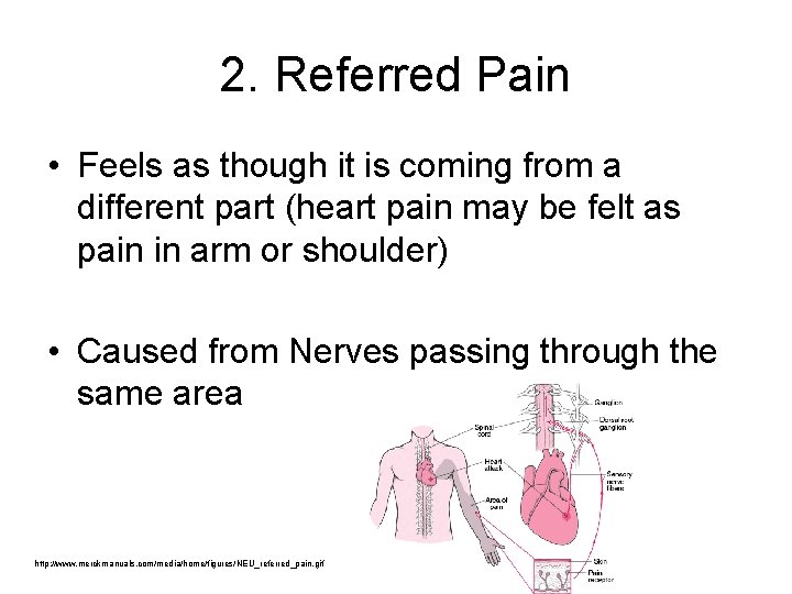 2. Referred Pain • Feels as though it is coming from a different part