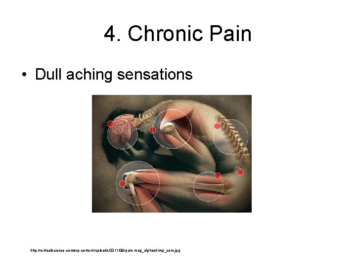 4. Chronic Pain • Dull aching sensations http: //criticalscience. com/wp-content/uploads/2011/08/pain-map_alphachimp_com. jpg 