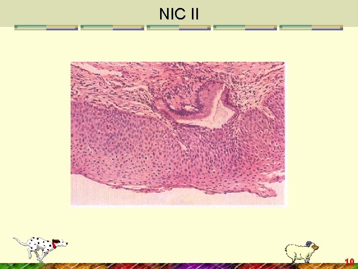 NIC II 10 