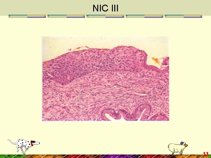 NIC III 11 