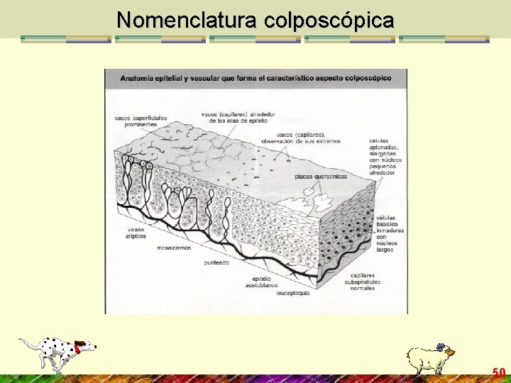Nomenclatura colposcópica 50 
