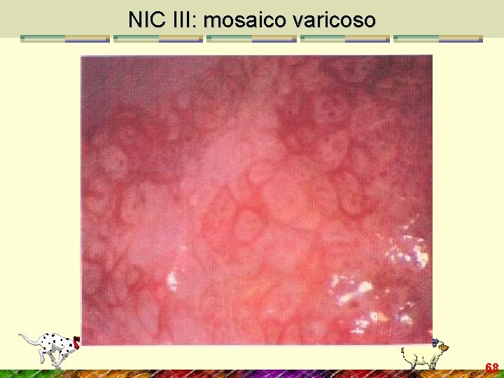 NIC III: mosaico varicoso 68 