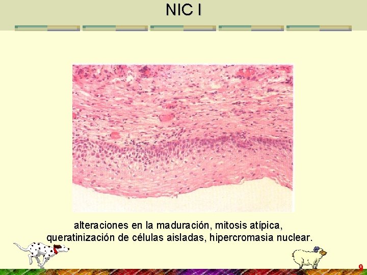 NIC I alteraciones en la maduración, mitosis atípica, queratinización de células aisladas, hipercromasia nuclear.