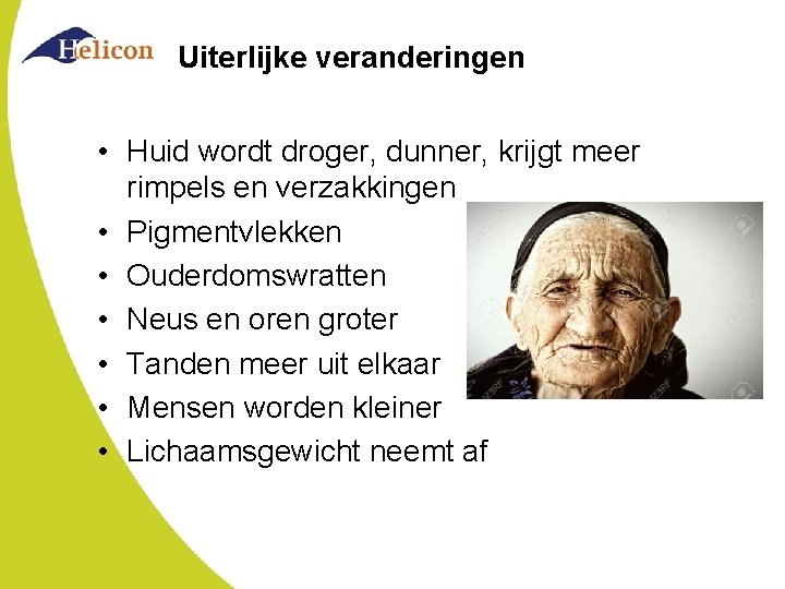 Uiterlijke veranderingen • Huid wordt droger, dunner, krijgt meer rimpels en verzakkingen • Pigmentvlekken Uiterlijke veranderingen • Huid wordt droger, dunner, krijgt meer rimpels en verzakkingen • Pigmentvlekken