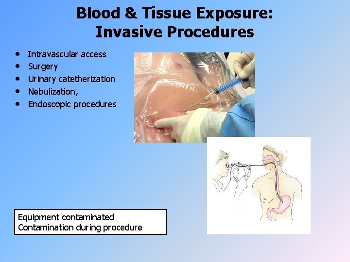 Blood & Tissue Exposure: Invasive Procedures • • • Intravascular access Surgery Urinary catetherization
