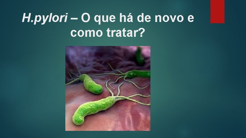 H. pylori – O que há de novo e como tratar? 