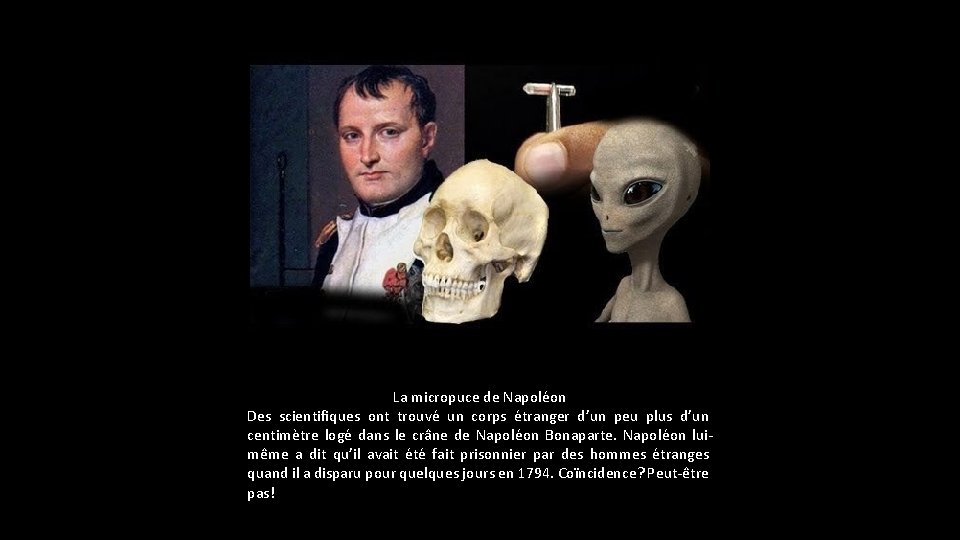 La micropuce de Napoléon Des scientifiques ont trouvé un corps étranger d’un peu plus