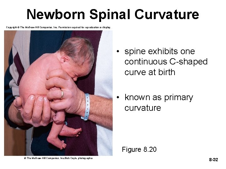 Newborn Spinal Curvature Copyright © The Mc. Graw-Hill Companies, Inc. Permission required for reproduction