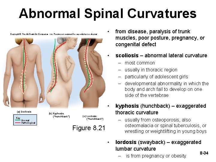 Abnormal Spinal Curvatures Copyright © The Mc. Graw-Hill Companies, Inc. Permission required for reproduction