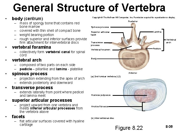 General Structure of Vertebra • body (centrum) – mass of spongy bone that contains