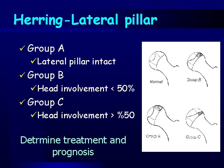 Herring-Lateral pillar ü Group A ü Group B ü Group C üLateral pillar intact