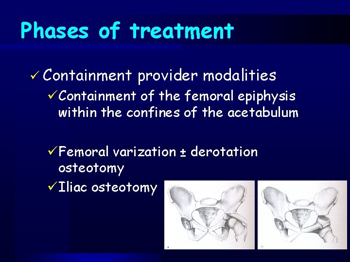 Phases of treatment ü Containment provider modalities üContainment of the femoral epiphysis within the