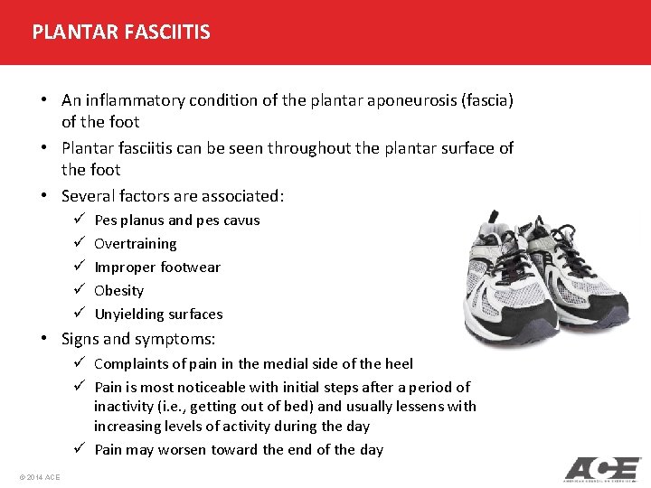 PLANTAR FASCIITIS • An inflammatory condition of the plantar aponeurosis (fascia) of the foot