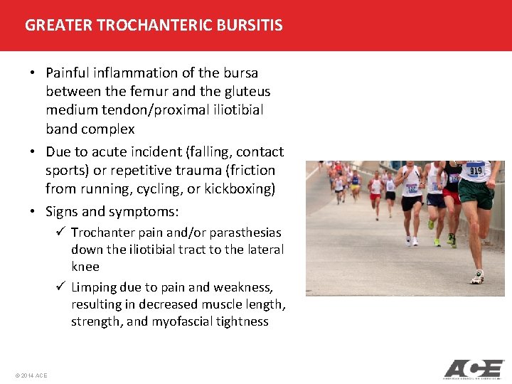 GREATER TROCHANTERIC BURSITIS • Painful inflammation of the bursa between the femur and the
