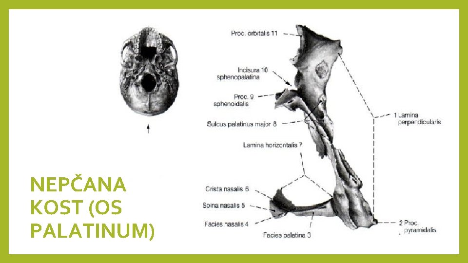 NEPČANA KOST (OS PALATINUM) 