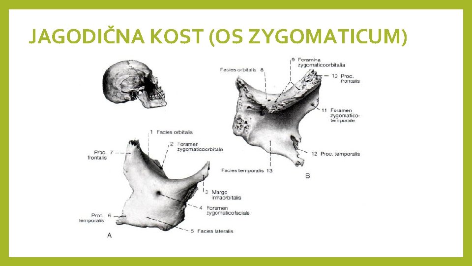 JAGODIČNA KOST (OS ZYGOMATICUM) 