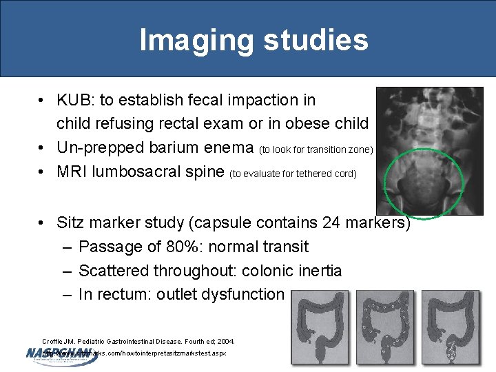 Imaging studies • KUB: to establish fecal impaction in child refusing rectal exam or
