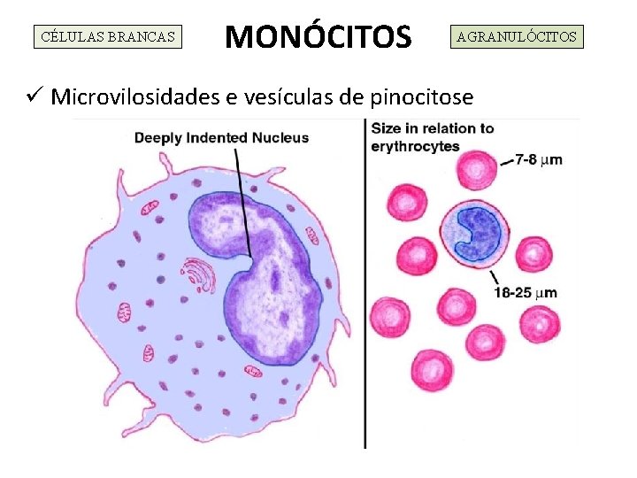CÉLULAS BRANCAS MONÓCITOS AGRANULÓCITOS ü Microvilosidades e vesículas de pinocitose 