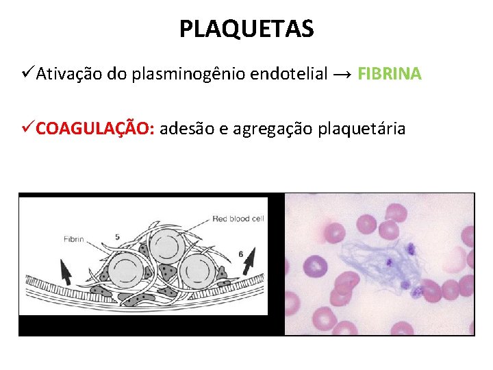 PLAQUETAS üAtivação do plasminogênio endotelial → FIBRINA üCOAGULAÇÃO: adesão e agregação plaquetária 