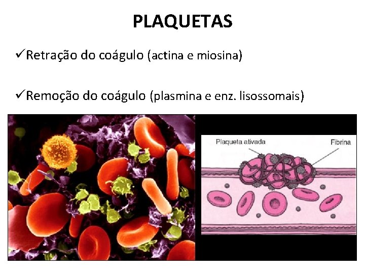 PLAQUETAS üRetração do coágulo (actina e miosina) üRemoção do coágulo (plasmina e enz. lisossomais)