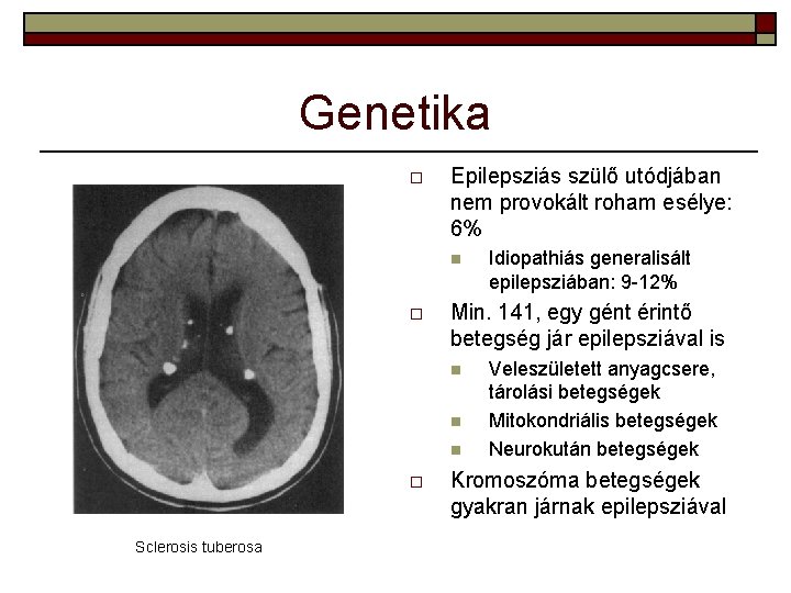 Genetika o Epilepsziás szülő utódjában nem provokált roham esélye: 6% n o Min. 141,