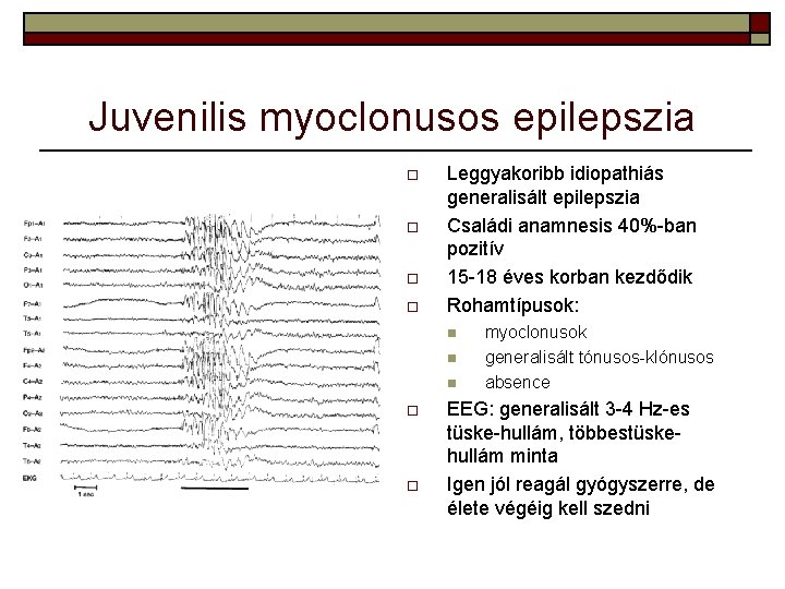 Juvenilis myoclonusos epilepszia o o Leggyakoribb idiopathiás generalisált epilepszia Családi anamnesis 40%-ban pozitív 15