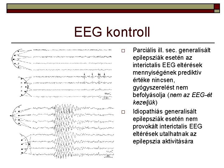 EEG kontroll o o Parciális ill. sec. generalisált epilepsziák esetén az interictalis EEG eltérések EEG kontroll o o Parciális ill. sec. generalisált epilepsziák esetén az interictalis EEG eltérések