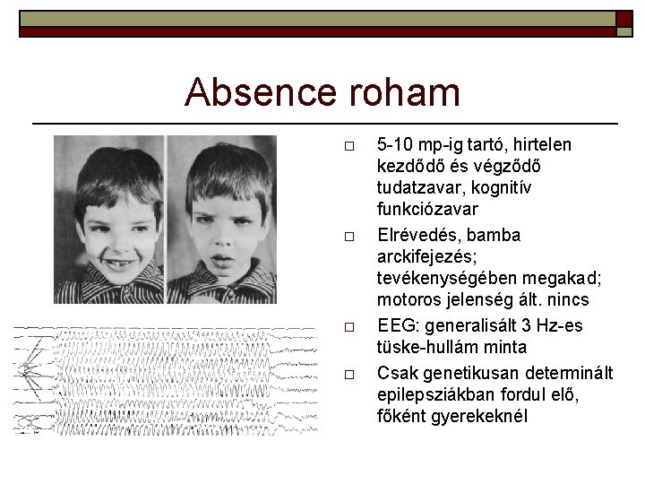 Absence roham o o 5 -10 mp-ig tartó, hirtelen kezdődő és végződő tudatzavar, kognitív Absence roham o o 5 -10 mp-ig tartó, hirtelen kezdődő és végződő tudatzavar, kognitív