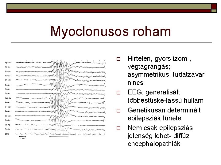 Myoclonusos roham o o Hirtelen, gyors izom-, végtagrángás; asymmetrikus, tudatzavar nincs EEG: generalisált többestüske-lassú