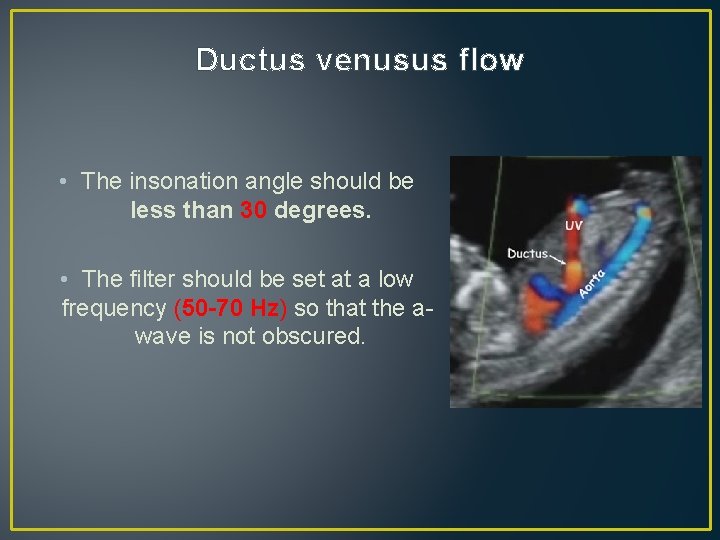 Ductus venusus flow • The insonation angle should be less than 30 degrees. • Ductus venusus flow • The insonation angle should be less than 30 degrees. •