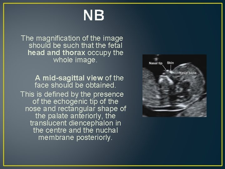 NB The magnification of the image should be such that the fetal head and NB The magnification of the image should be such that the fetal head and