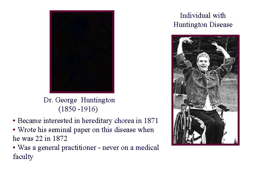 Individual with Huntington Disease Dr. George Huntington (1850 -1916) • Became interested in hereditary