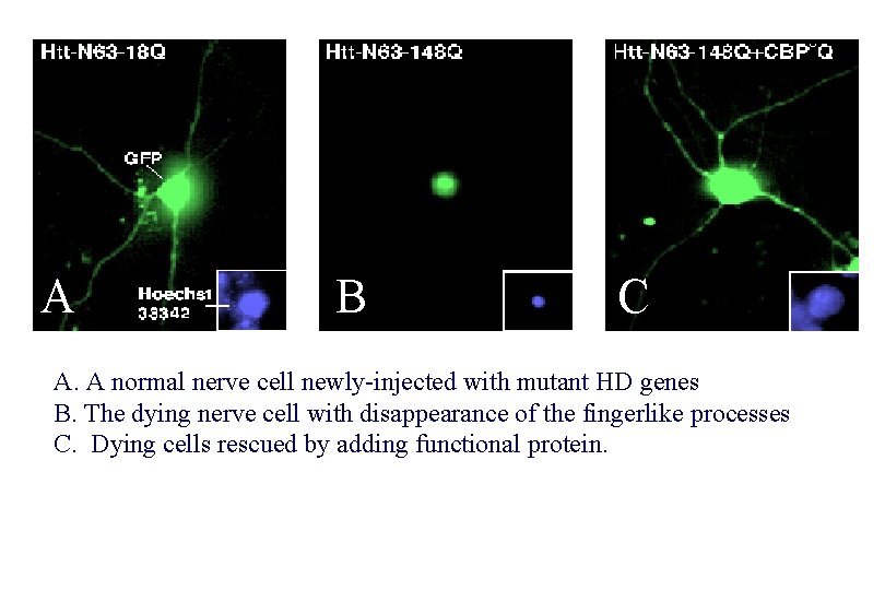 A B C A. A normal nerve cell newly-injected with mutant HD genes B.