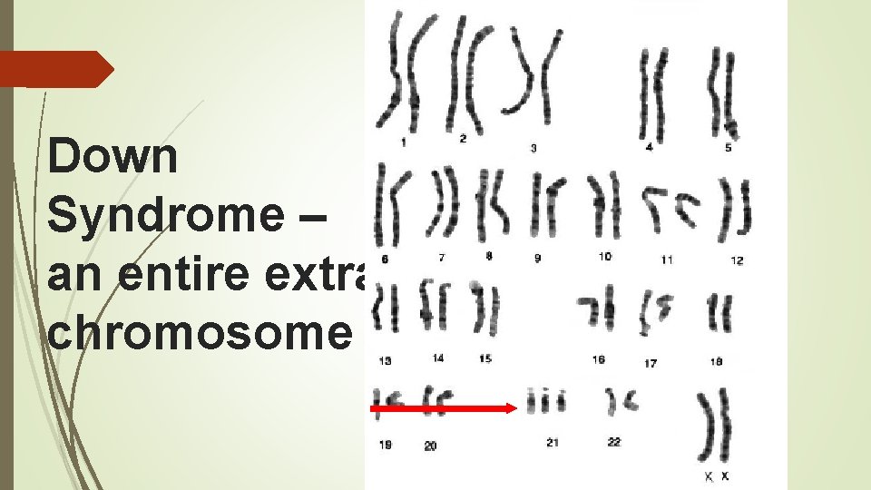 Down Syndrome – an entire extra chromosome 