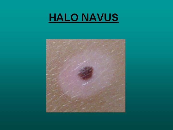 HALO NAVUS 