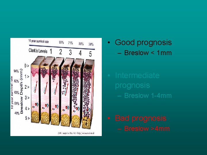  • Good prognosis – Breslow < 1 mm • Intermediate prognosis – Breslow