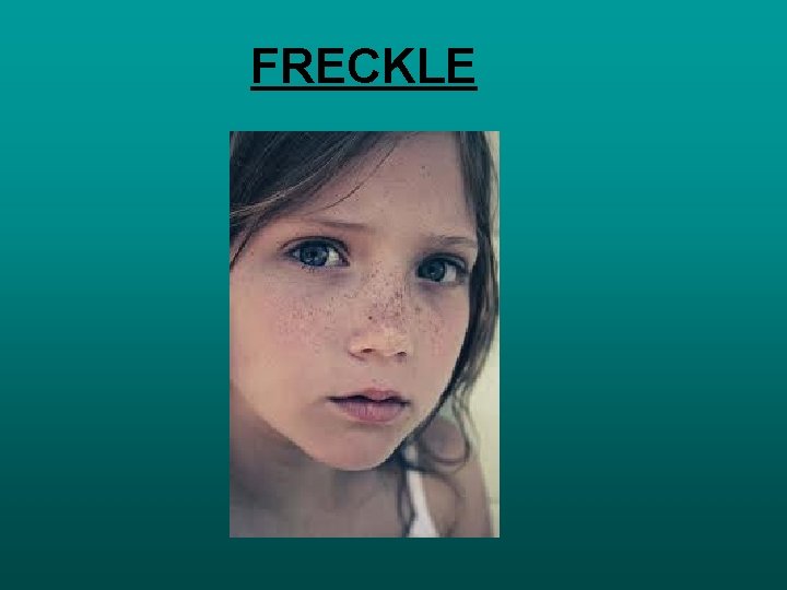 FRECKLE 
