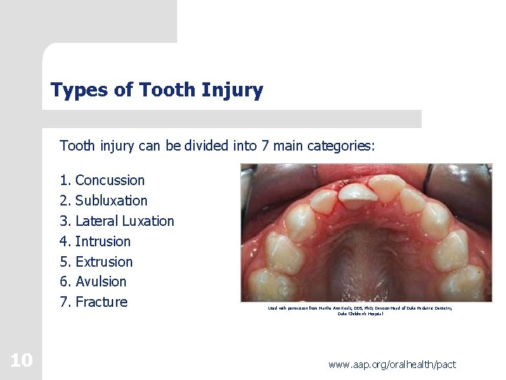 Types of Tooth Injury Tooth injury can be divided into 7 main categories: 1.