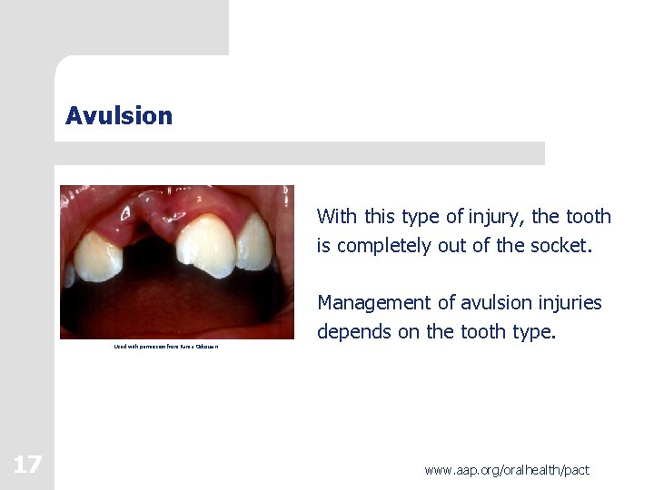 Protecting All Childrens Teeth Oral Injury 1 www