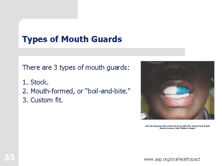 Types of Mouth Guards There are 3 types of mouth guards: 1. Stock. 2.
