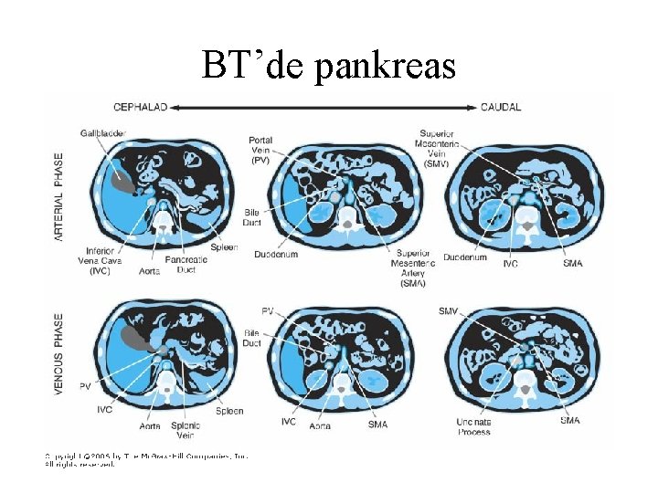 BT’de pankreas 